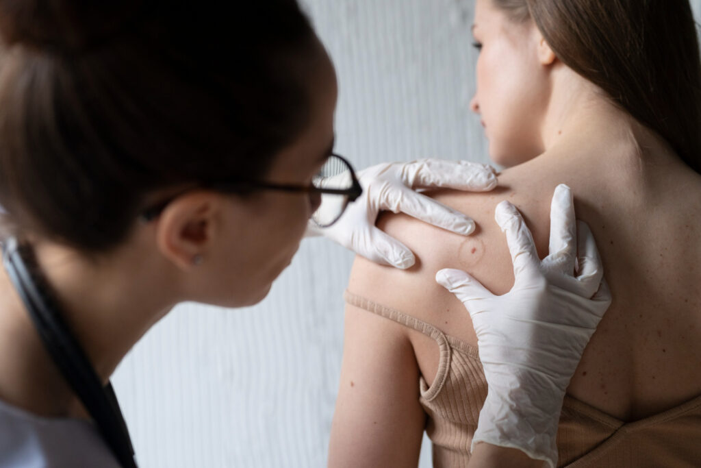 melanoma for dermatologic surgery